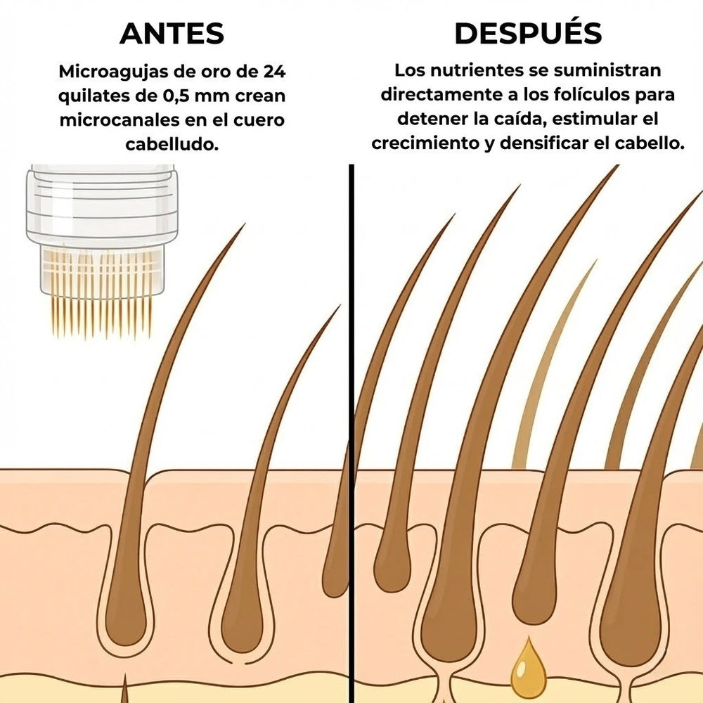 Novacell Microinfuse
